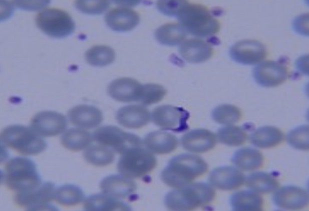 <p>Identify the kinetoplastid. Causes Chagas’ disease</p>