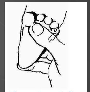 <p>This is an example of what reflex…</p>