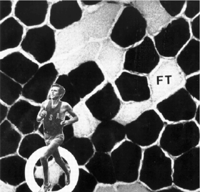<p>Gastrocnemius muscle from a world-class marathon runner, Frank Shorter (Olympic gold, 1972; silver, 1976)</p><p></p><p>In the histological image, dark fibers represent __________ muscle fibers.</p>