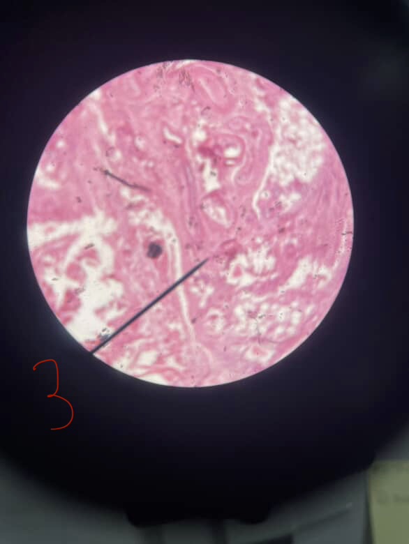 <p>a) Is it C, E, M, N?</p><p>b)Name it</p>