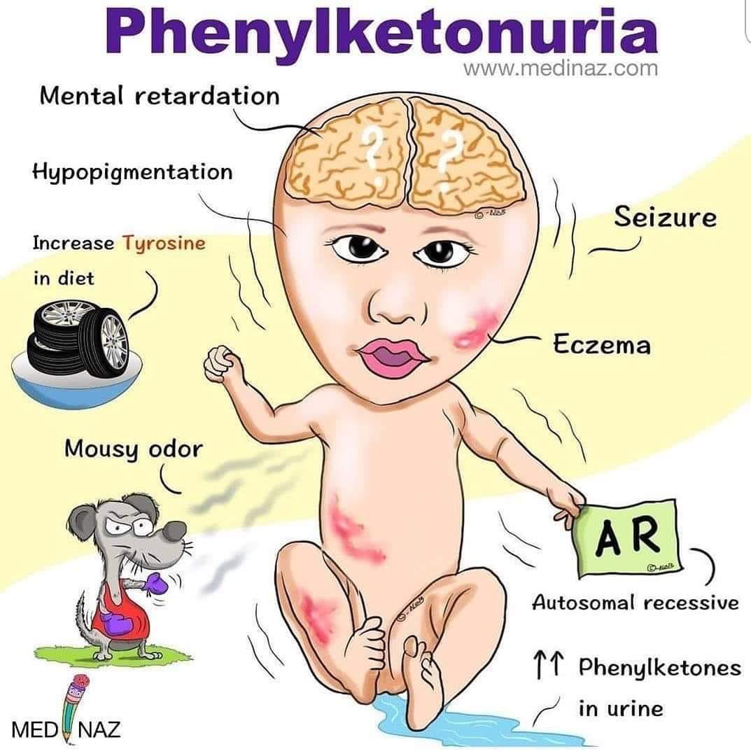 <p>Phenylketonuria (PKU)</p>
