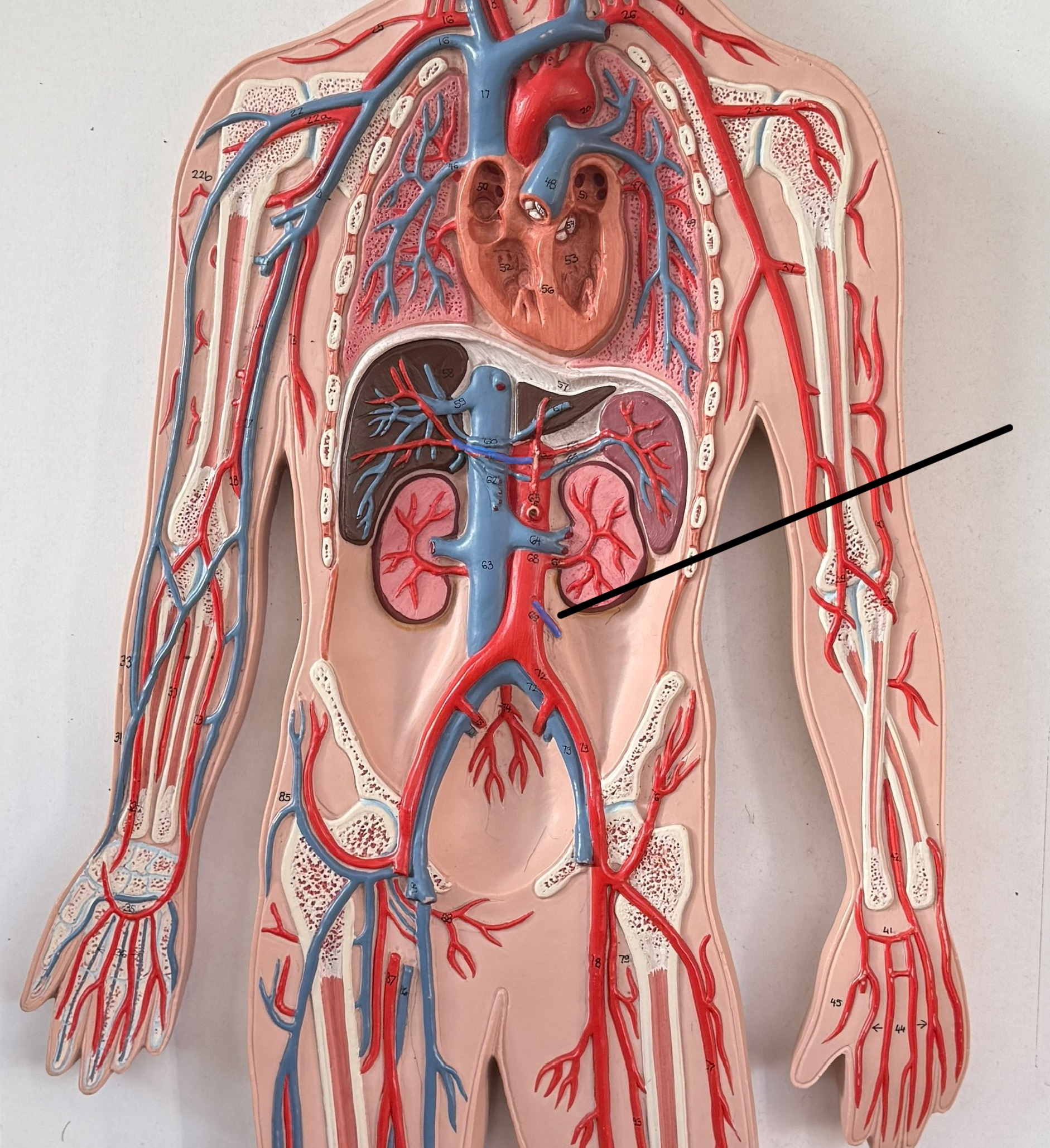 <p>Which artery is this?</p>