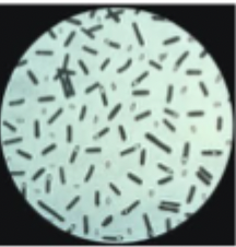 <p>Which species of Clostridium do these spores belong to?</p>