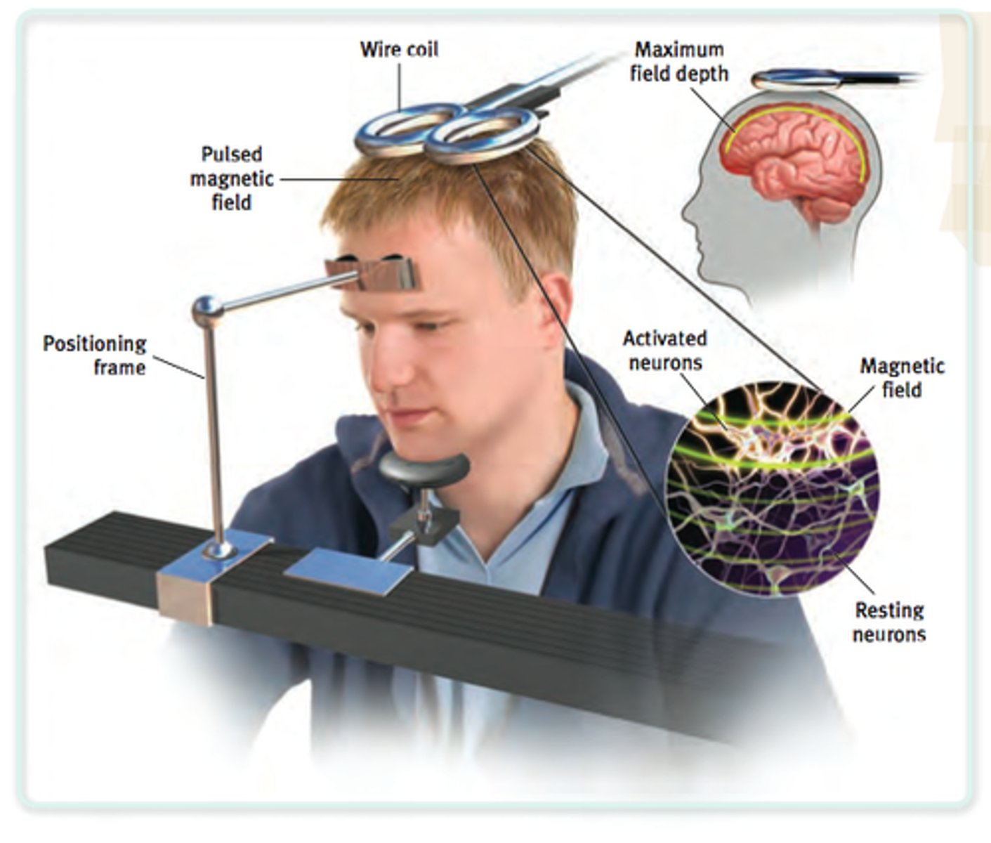<p>Uses very fast and powerful magnetic field to momentarily disrupt activity in specific brain region</p>