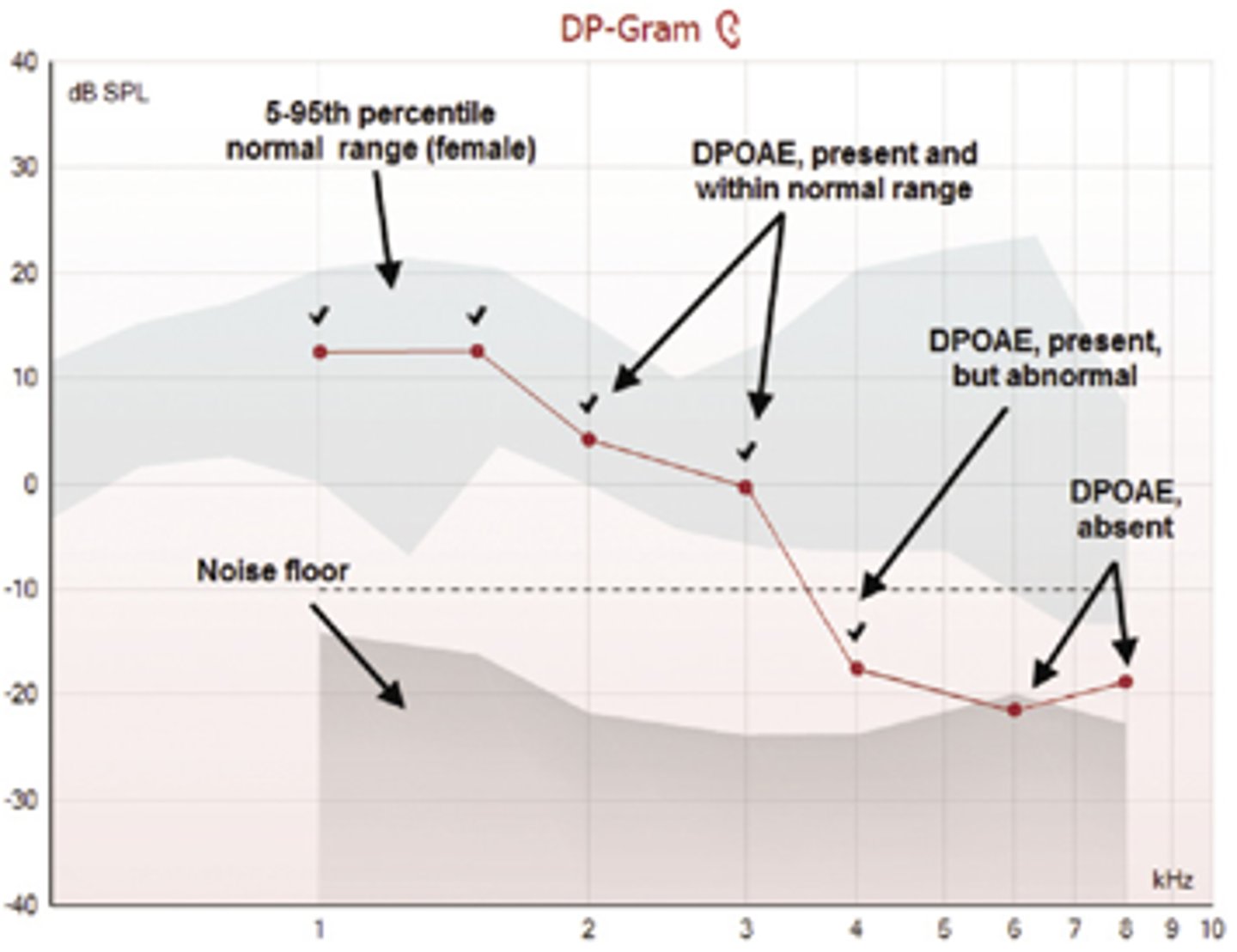 <p>A graph showing the amplitude of distortion product otoacoustic emissions plotted as a function of the stimulus frequency (usually the f2 stimulus). See distortion product otoacoustic emissions.</p>