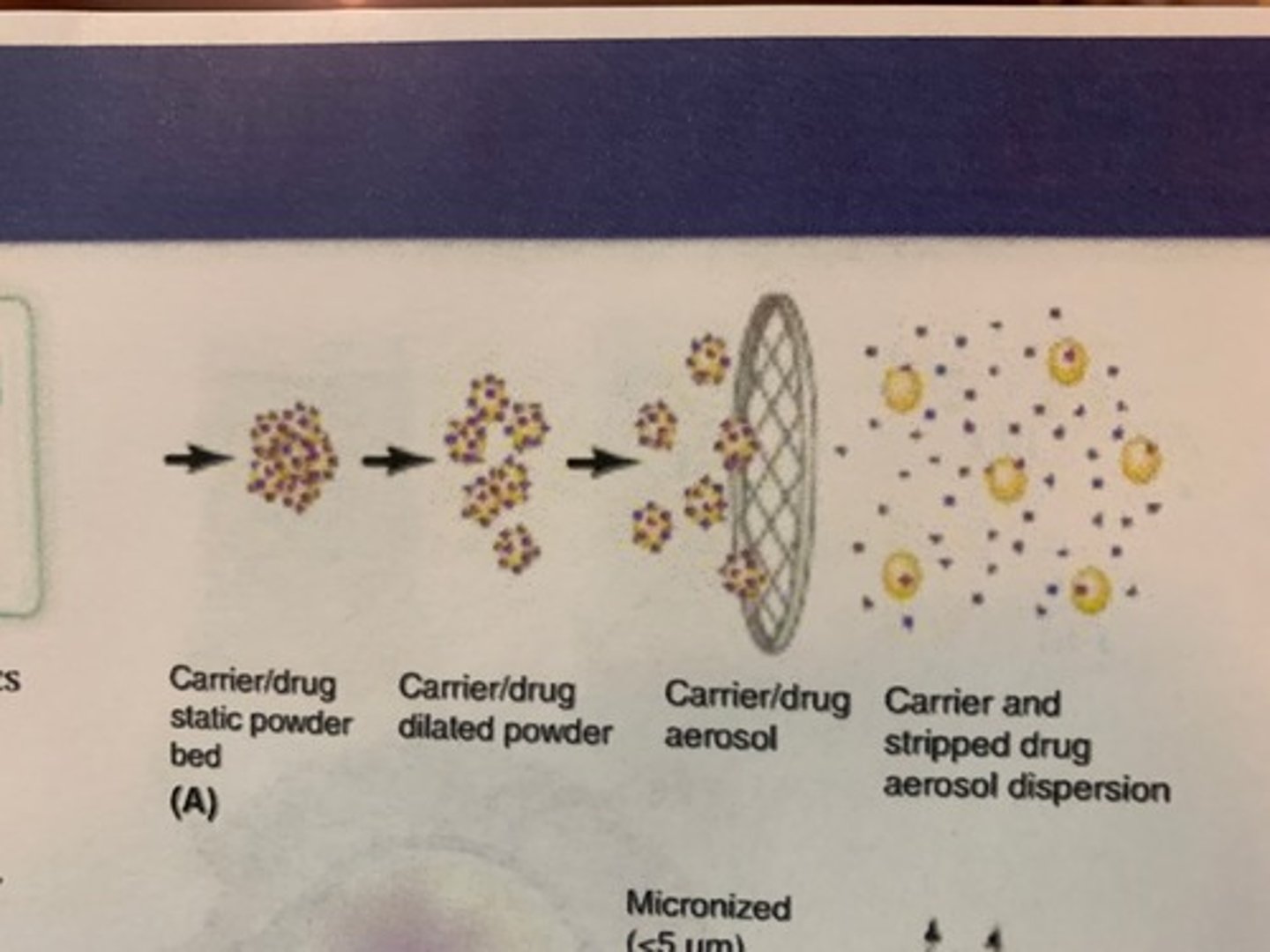<p>1. Fluidisation</p><p>- Static bed: At first particles aren't doing anything</p><p>- There is a pressure drop when patient begins to inhale.</p><p>- When the pressure difference between the top and bottom of the particles is large enough the particles become fluidised to produce a dilated powder bed</p><p>2. Entrainment</p><p>- Here particles begin to fly through the air out of the mouth piece of the inhaler.</p><p>- Particles are agglomerated (stuck together), so are too large to impact in alveoli or bronchioles.</p><p>3. De-aggregation</p><p>- Particles are pulled apart in airflow via various forces.</p><p>- Now, not all, but most particles are small enough to be inhaled into the lungs.</p><p>- Devices can mesh inside the mouthpiece which encourage de-aggregation.</p>