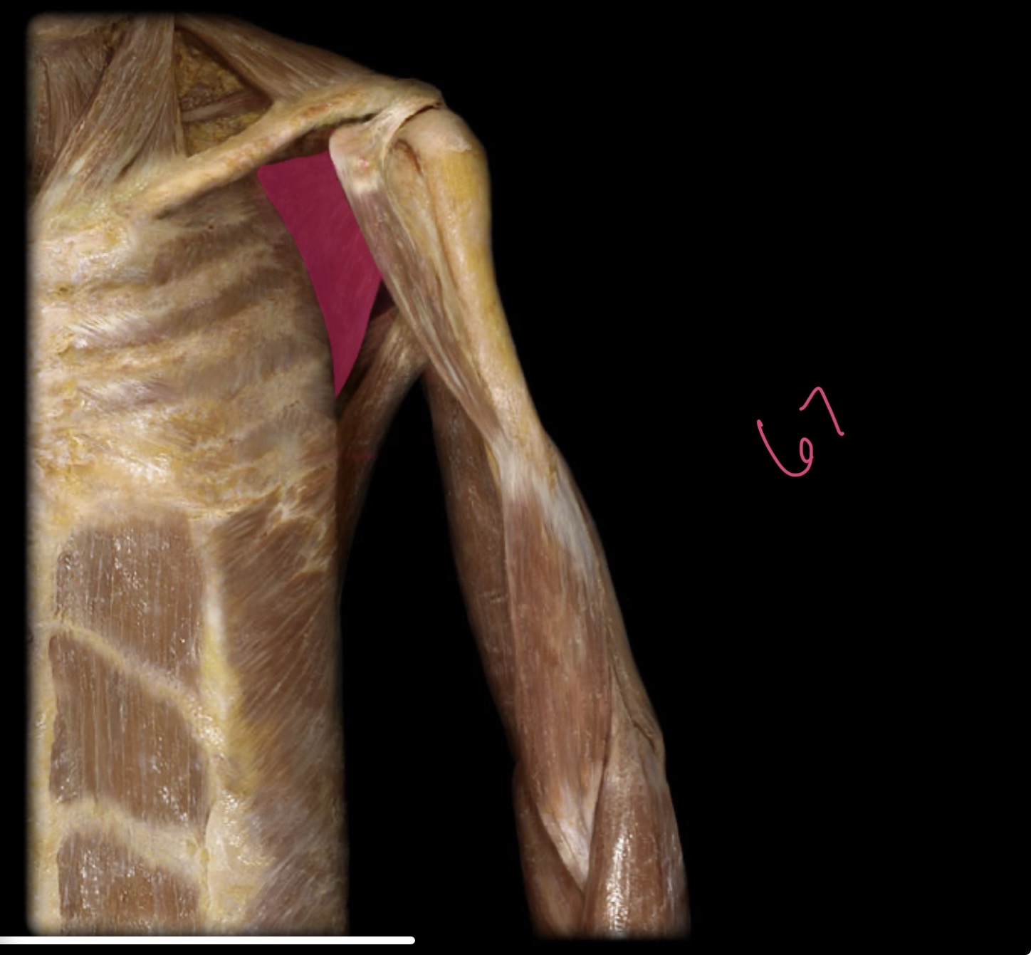 <p>Subscapularis</p>