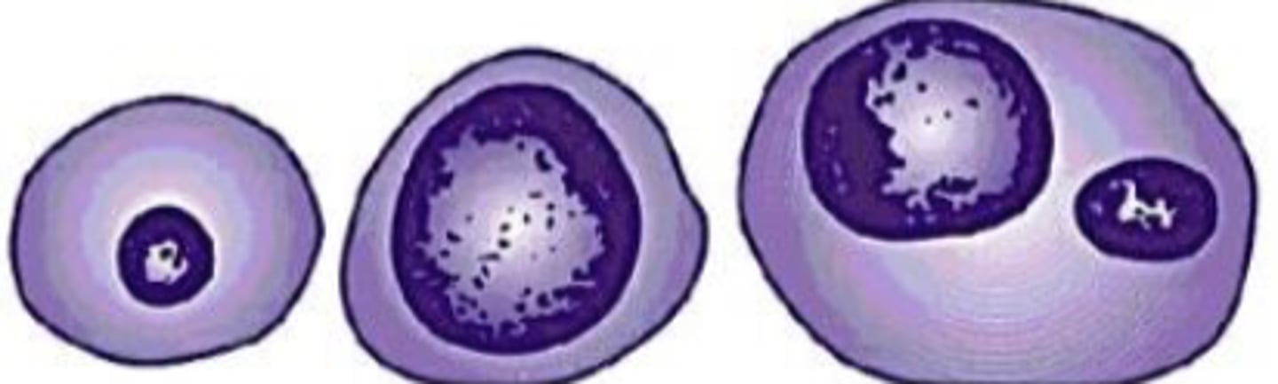 <p>What term is used for variation in nuclear size?</p>
