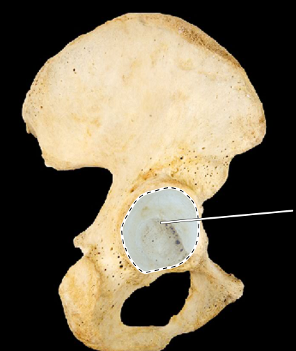 <p>Hip bone, lateral view, right pubis</p>