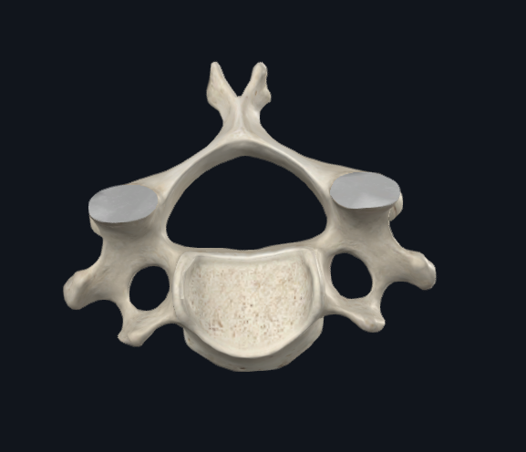 <p>What type of vertebra is this</p>