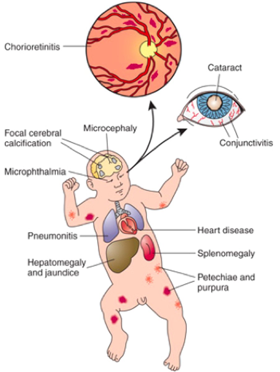 <p>A group of infections (Toxoplasmosis, Other, Rubella, Cytomegalovirus, Herpes) that can cause severe fetal anomalies.</p>