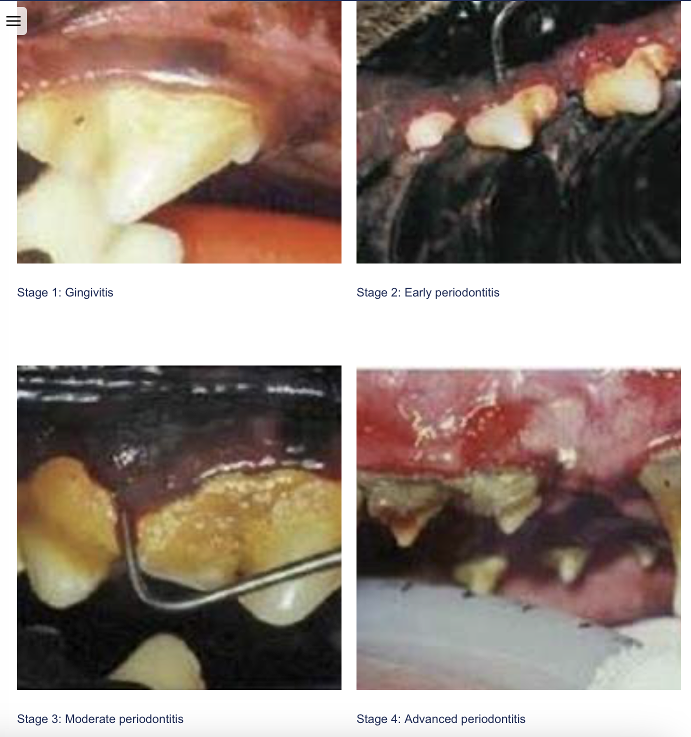 <p><span data-name="bookmark" data-type="emoji">🔖</span><span style="line-height: inherit; font-size: inherit;"><strong><span>Periodontal disease</span></strong></span><span style="line-height: inherit;"><span>, also known as gum disease, affects the gums, jawbones, and soft tissue around the teeth. It is a progressive, inflammatory condition that results in tooth loss, gum inflammation, bad breath, and infection. It can also cause issues elsewhere in the body if an infection travels.</span></span></p>