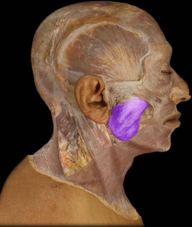 <ul><li><p>Action: Elevation of mandible (e.g., closing mouth), Protraction of mandible</p></li><li><p>Origin: Zygomatic arch</p></li><li><p>Insertion: Mandible (external surface of angle and ramus)</p></li><li><p>Innervation: Trigeminal nerve (mandibular division - CN V3)</p></li></ul><p></p>