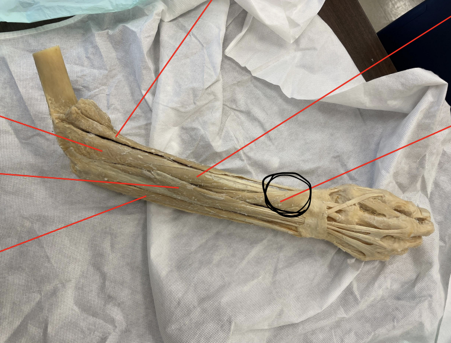 <p>identify + state origin, insertion, action, innervation of marked structure</p>