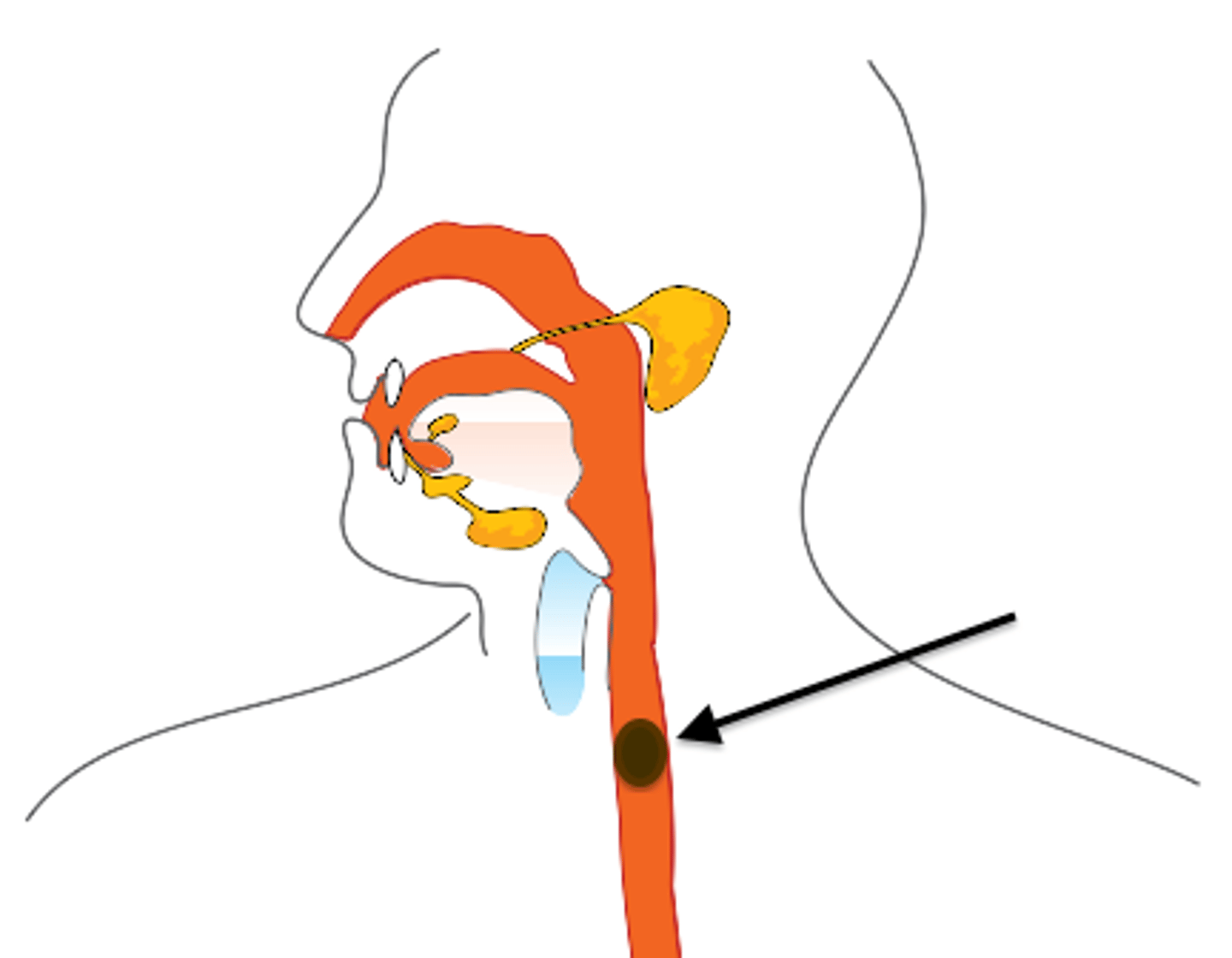 <p>food that has been chewed, mixed with saliva and made into a clump which can travel down the GI tract to the stomach</p>