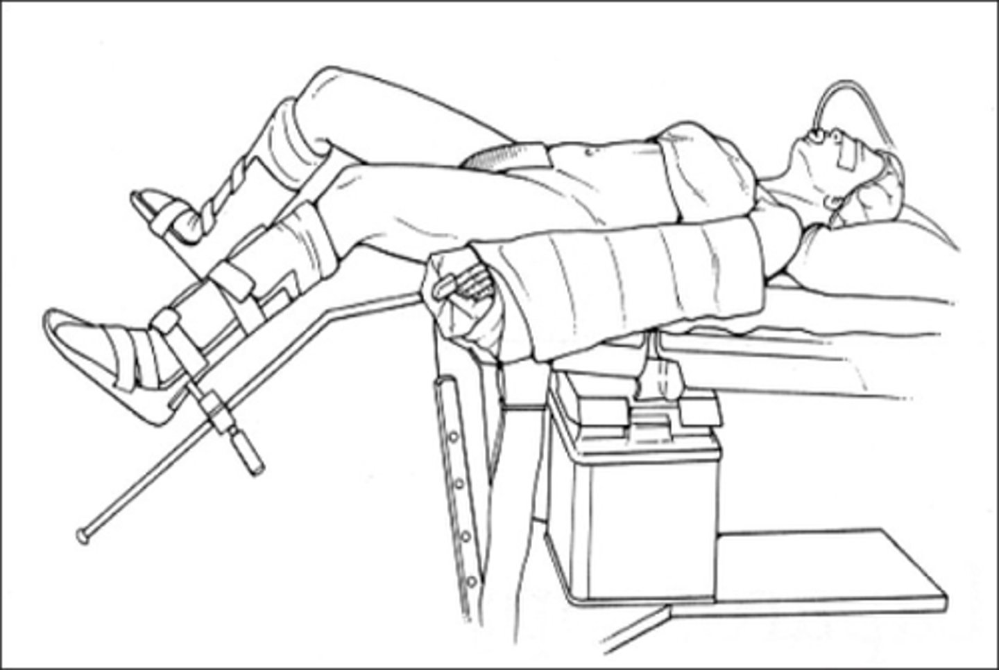 <p>Low-lithotomy</p>