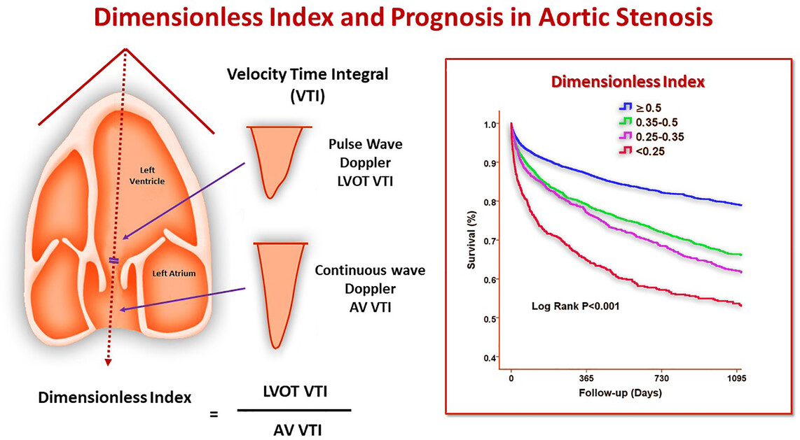 <p>DOI= LVOT VTI / AVR VTI</p>