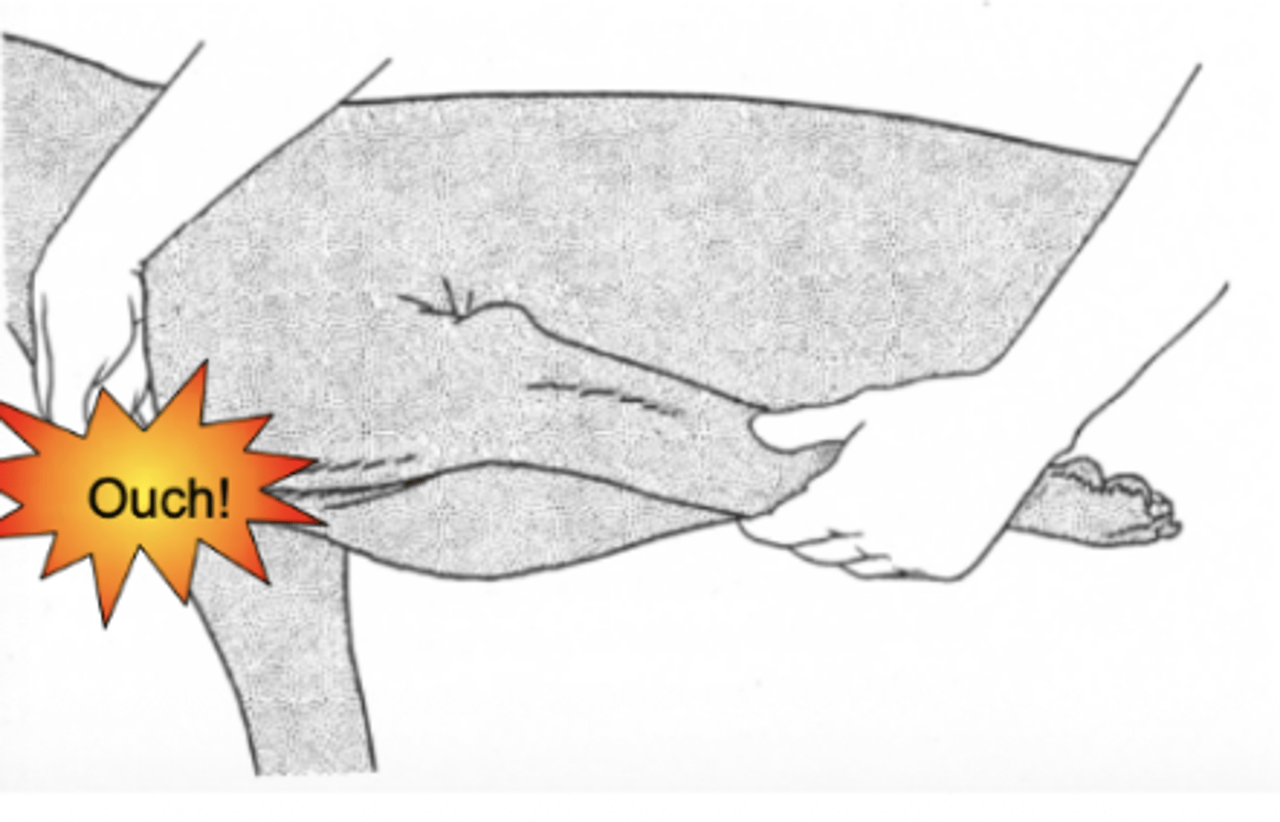 <p>How does one perform a biceps tenosynovitis test?</p>