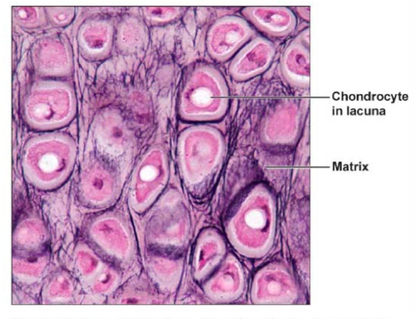 <p>similar to hyaline cartilage, but more elastic fibers in matrix</p>