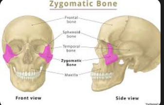 <p>bone that forms the prominence of the cheek and part of the eye socket, often referred to as the cheekbone. </p>