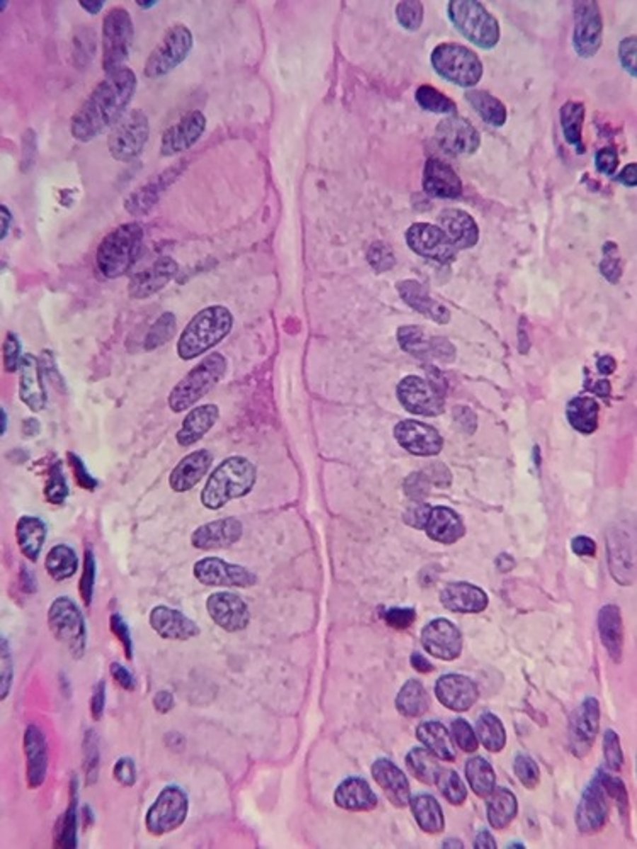 <p>what is this type of tissue and where is it found?</p>