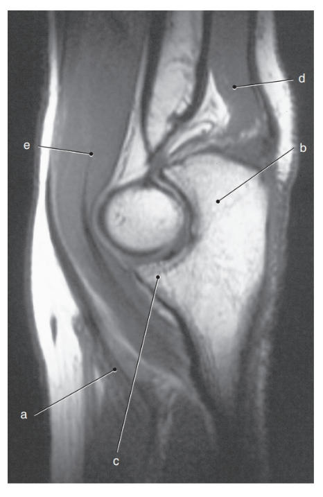 <p>What is letter c ?</p>
