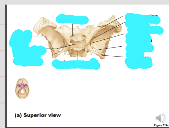 <p>describe the sphenoid bone</p>
