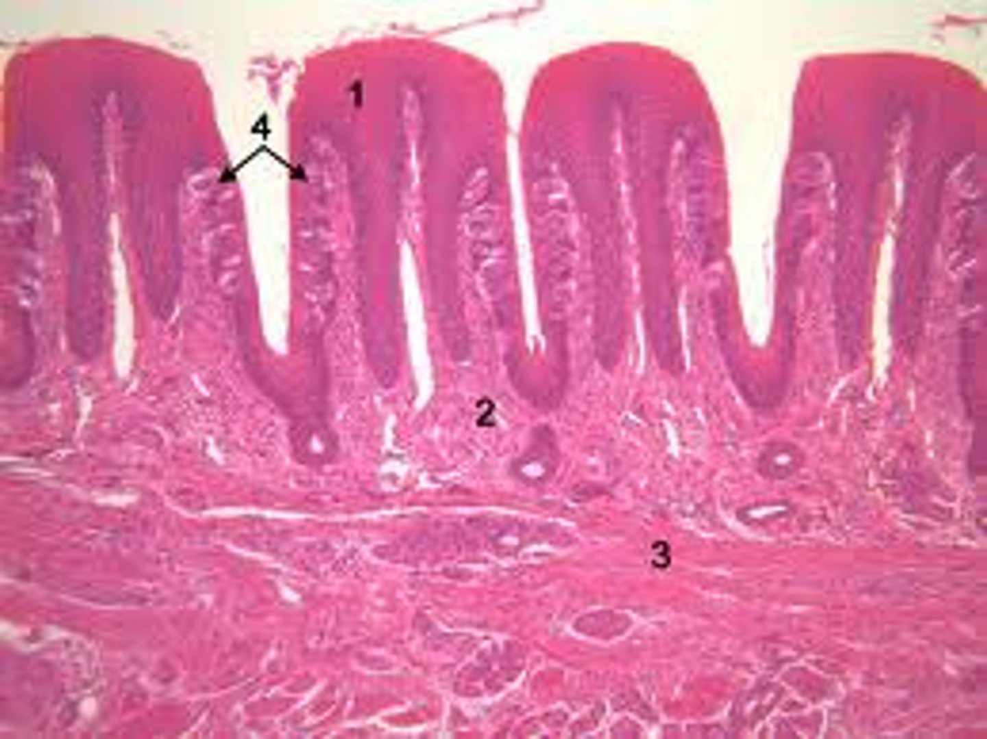 <p>all over tongue, concentrated on the lateral sides</p>