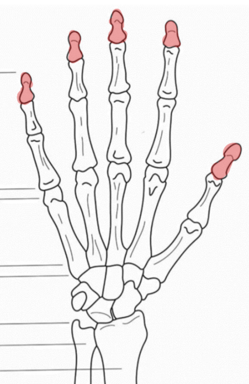 <p>Wat is hier aangeduid</p>