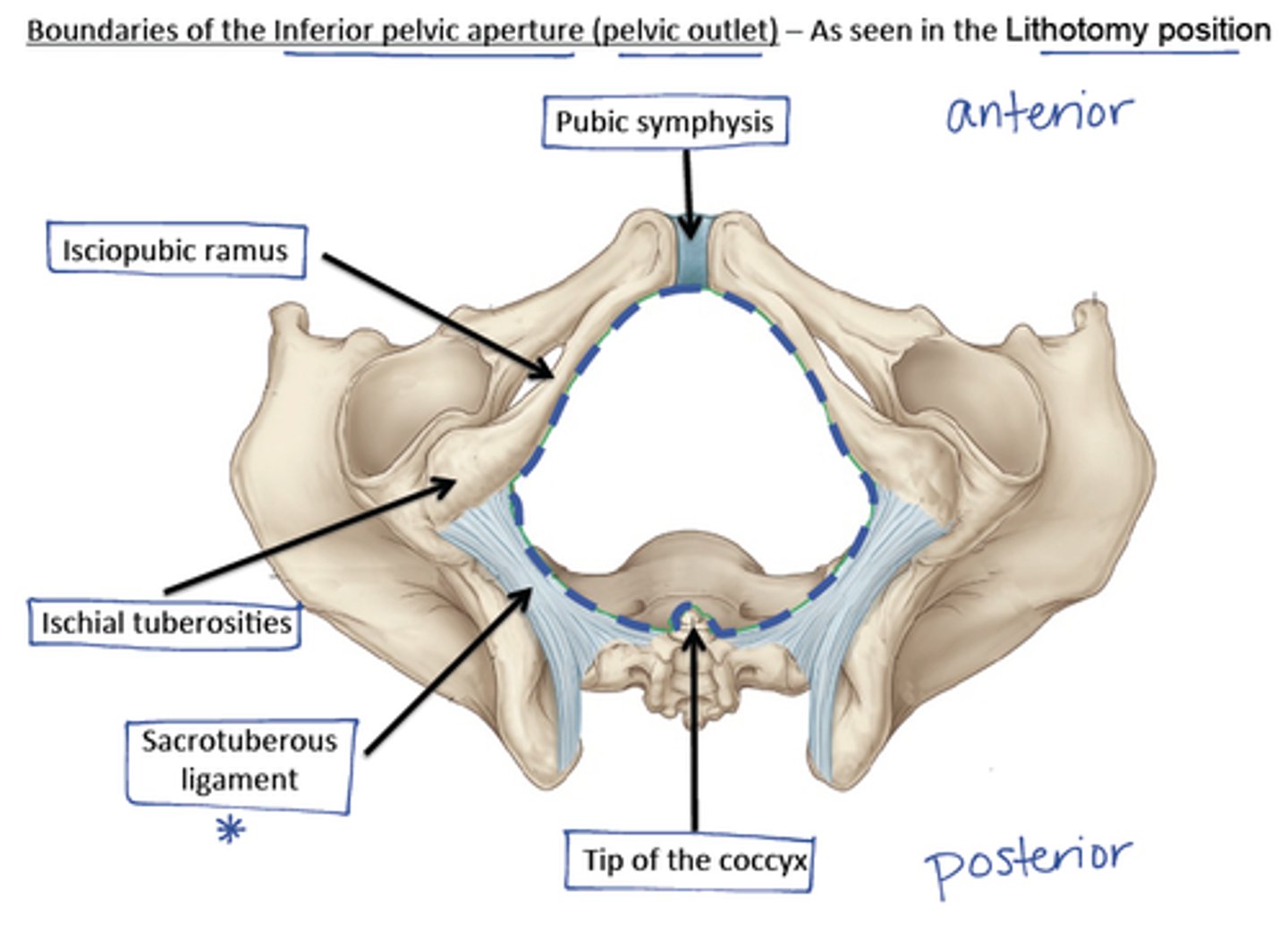 <p>inferior opening of the true pelvis</p><p>a line from the lower border of sacrum to lower part of pubic symphysis</p>