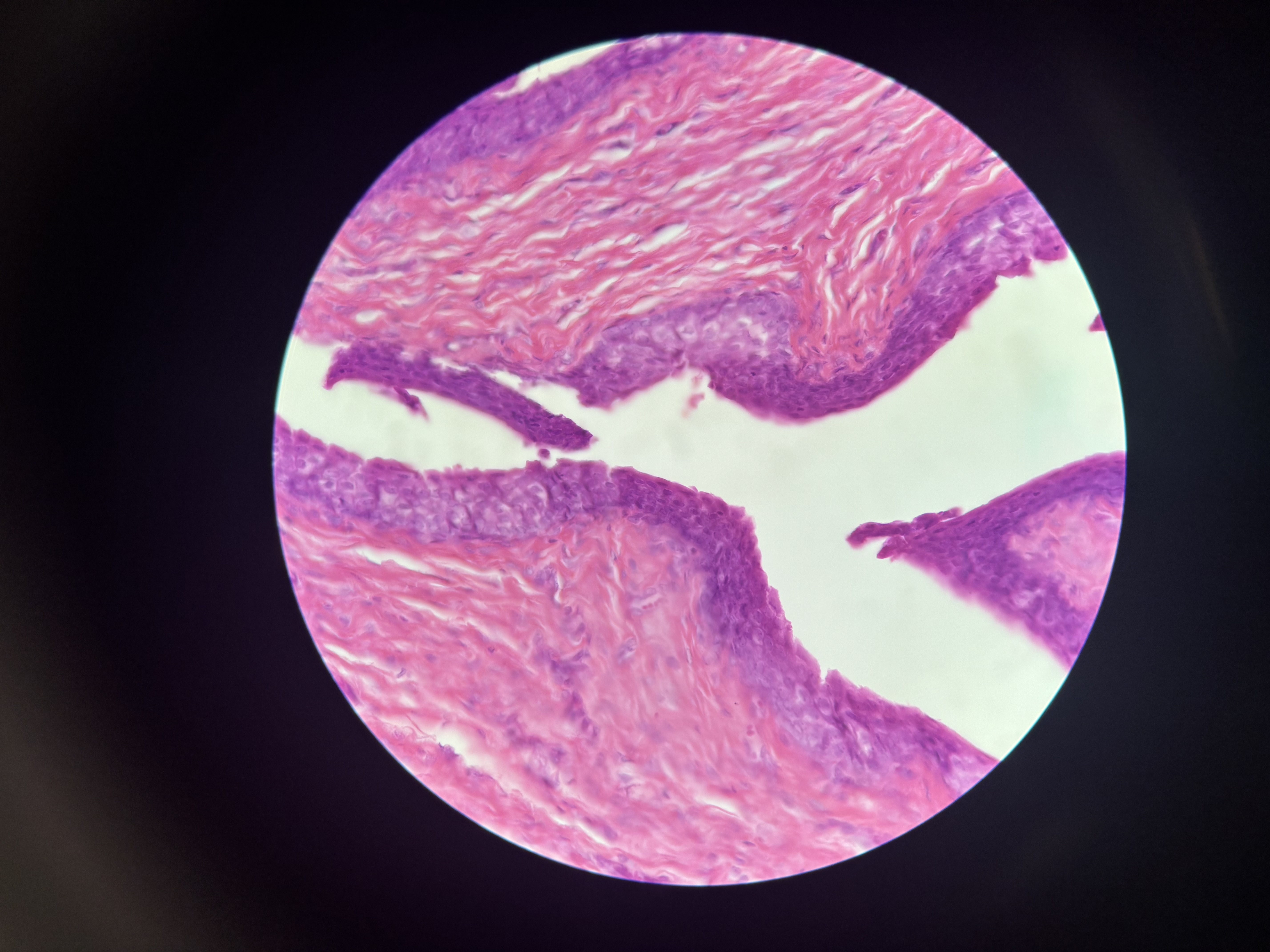 <p>Stretches,, is found in urinary system</p>
