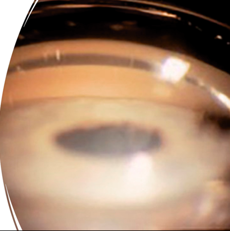 <p>what is the most posterior structure shown here &amp; what is the function? </p>