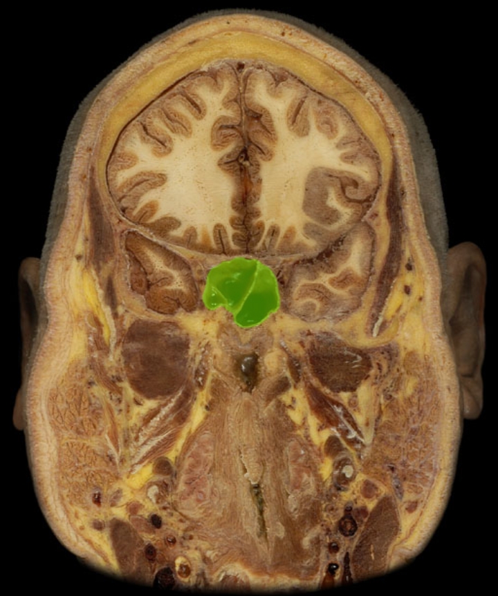 term image
