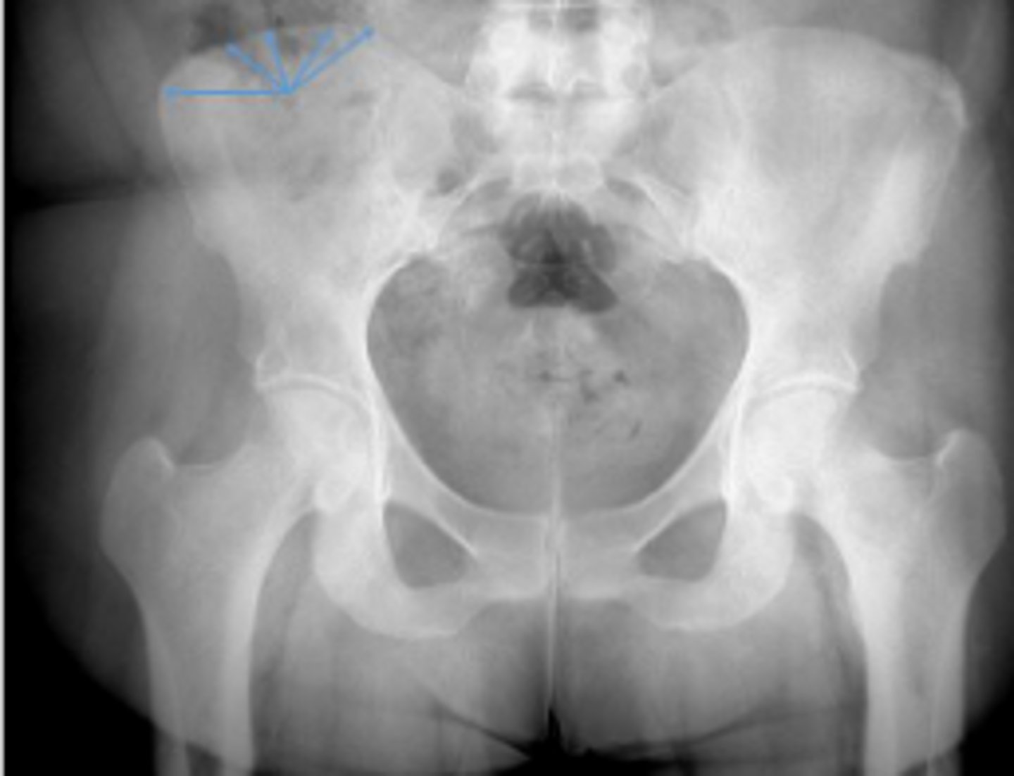 <p>What are the arrows pointing to?</p>