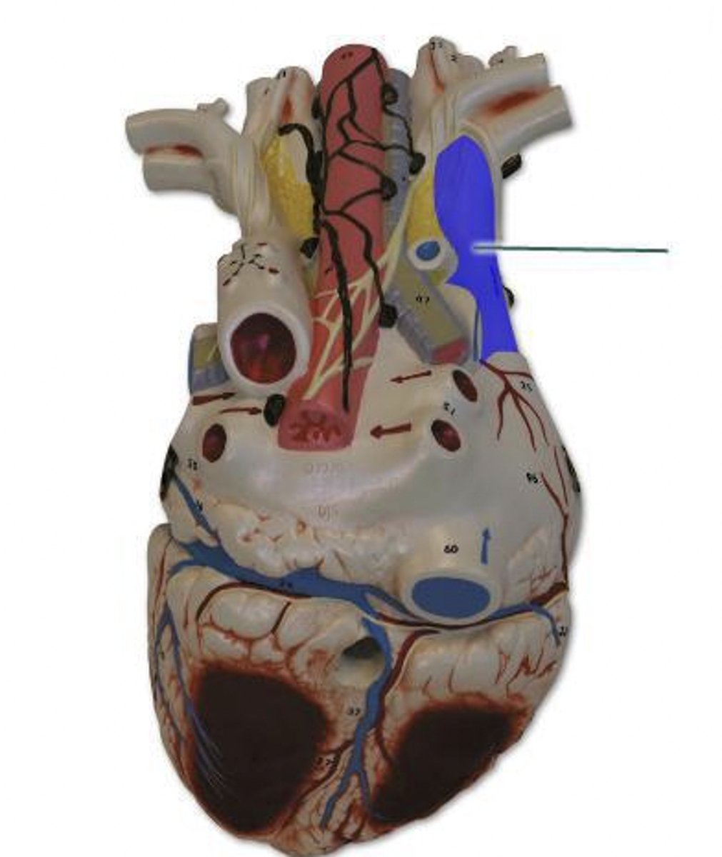 <p>identify the highlighted vessel.</p>