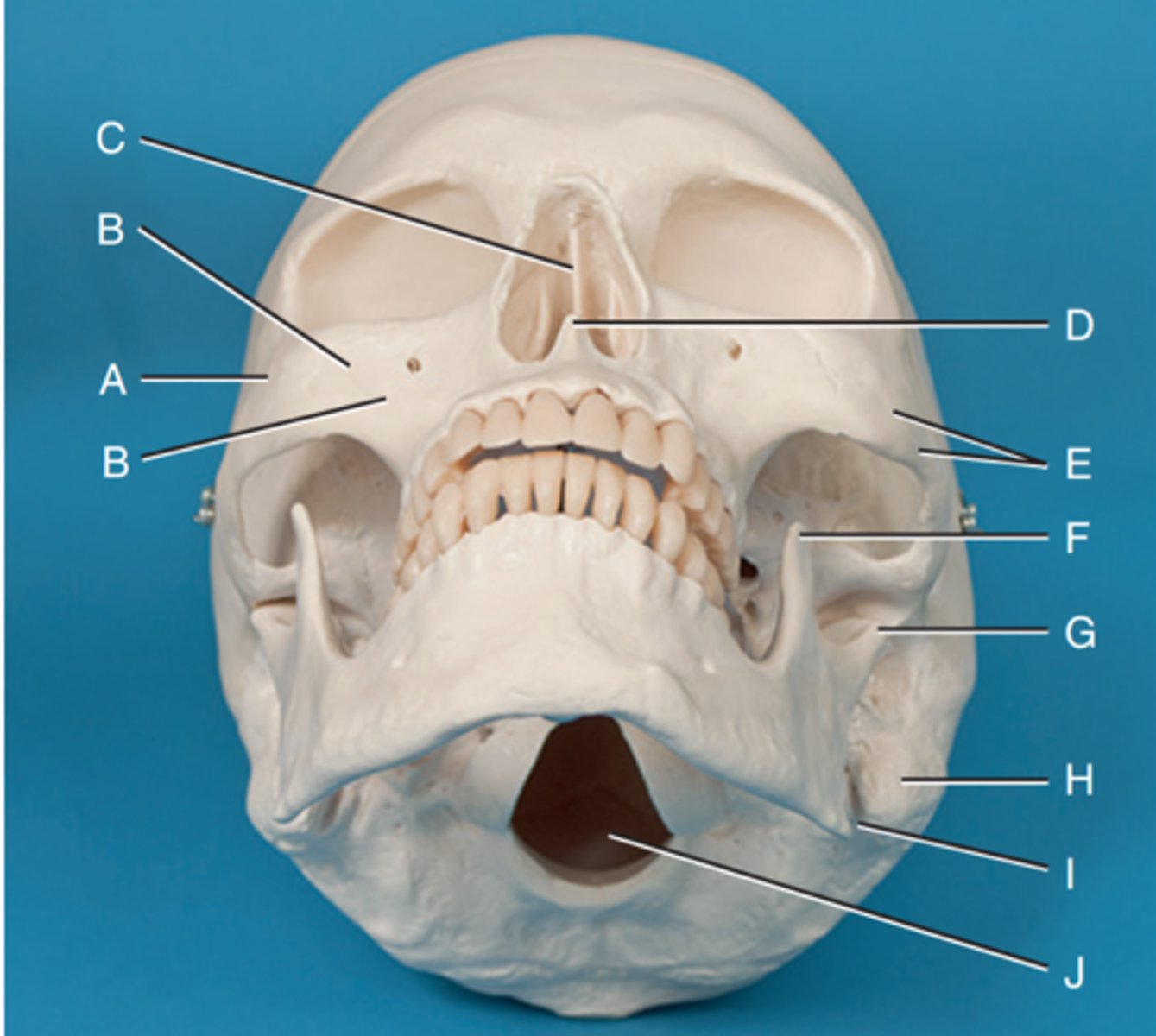 <p>Label D</p>