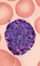 <ul><li><p>A type of White blood cell (Leukocytes)</p></li></ul><p></p><p><u>Granulocytes</u></p><ul><li><p>Rarest WBCs, make up only 0.5-1%</p></li><li><p>Large, purplish-black granules contain <strong>histamine</strong></p><ul><li><p>Histamine is a inflammatory chemical that acts as a vasodilator (makes blood vessels dilate) amd attracts other WBCs to the inflamed site.</p></li></ul></li></ul><p>Characteristics:</p><ul><li><p>Bilobed nucleus</p></li><li><p>Purplish-black cytoplasmic granules</p></li><li><p>Nucleus deep purple with one to two constrictions, U or S shaped and a little hard to see  </p></li></ul><p></p>