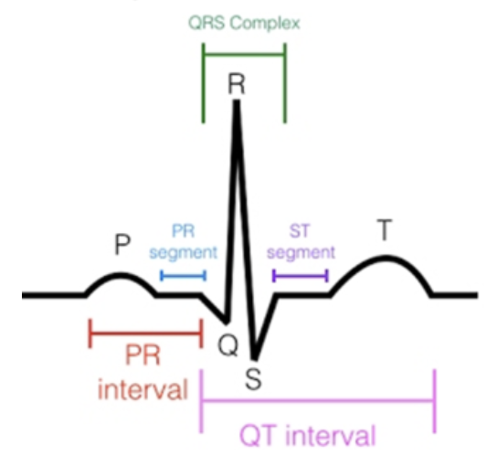 <ul><li><p>Wave that <strong>precedes (comes before)</strong> the <u>QRS wave complex</u></p></li><li><p><u>represents</u> <span style="color: rgb(255, 0, 0)">atrial depolarization</span></p></li><li><p>smooth and rounded</p></li><li><p><strong>positive</strong> deflection</p><ul><li><p>above baseline</p></li></ul></li><li><p><span style="color: rgb(255, 0, 0)">0.5 - 2.5 mm</span> in <strong>amplitude</strong></p></li></ul><p></p>