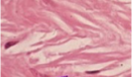 <p>What connective tissue fiber is shown in the following image?</p>
