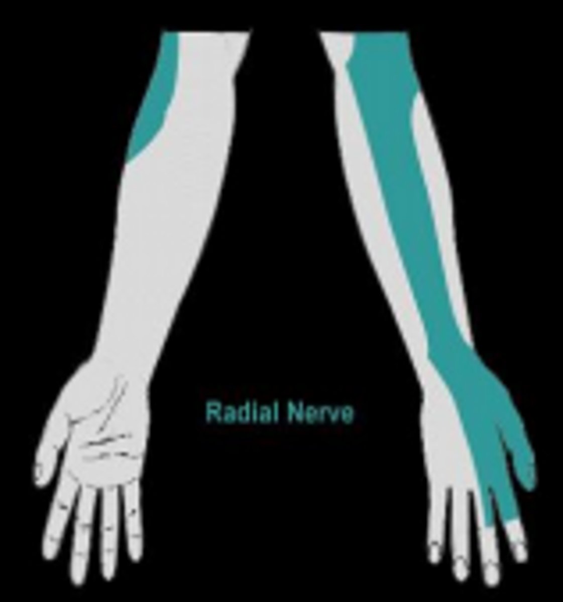 <p>Sensory innervation: skin over dorsolateral arm, forearm and hand</p><p>Motor innervation: Posterior compartment of arm and forearm (extensors)</p><p>- triceps brachii, extensors</p><p>if damaged: difficulty extending elbow, wrist drop</p>