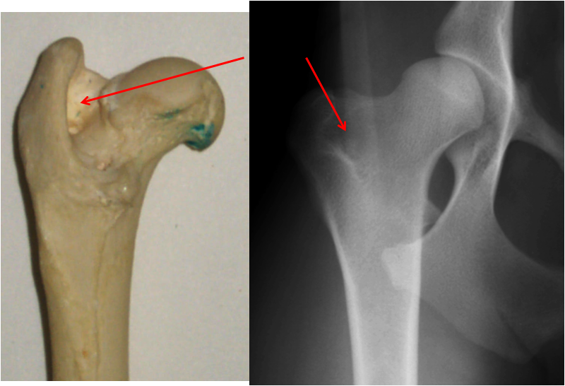 <p>name a muscle which attaches here</p>