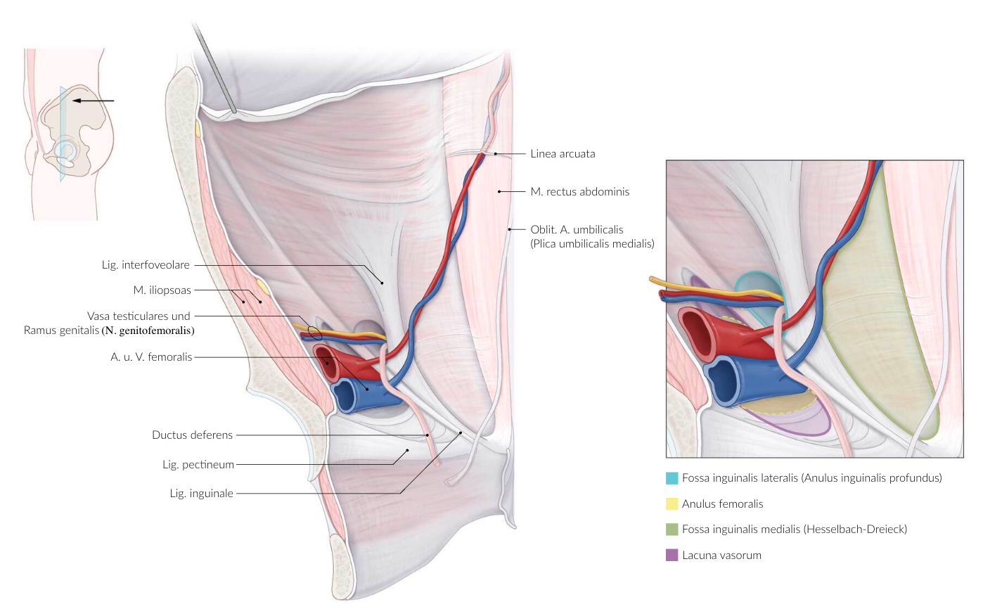 <p>B. Medial inguinal fossa (Fossa inguinalis medialis)</p>
