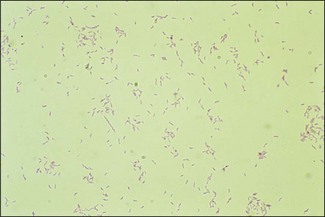 <p>Stain method. Useful for recognizing campylobacter spp, brachyspira spp, and fusobacterium spp which stain red.</p>