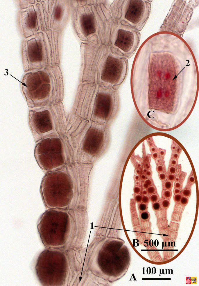 <p>blood thing</p>
