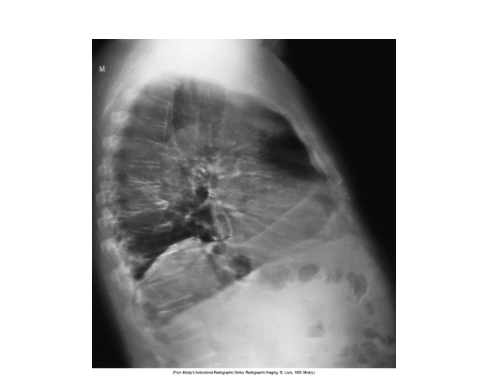 <p>What is affecting this image</p>