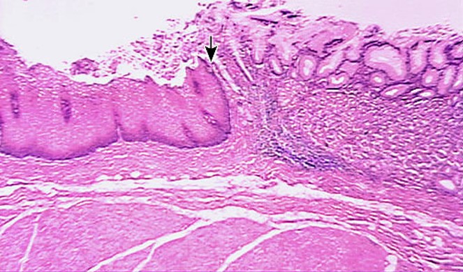 <p>Esophageal glands lubricate</p>