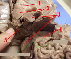 <p>What is structure#2 ? What’s it function? </p>