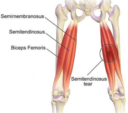 <p><span><span>Leg muscles: Flexors are what?</span></span></p>
