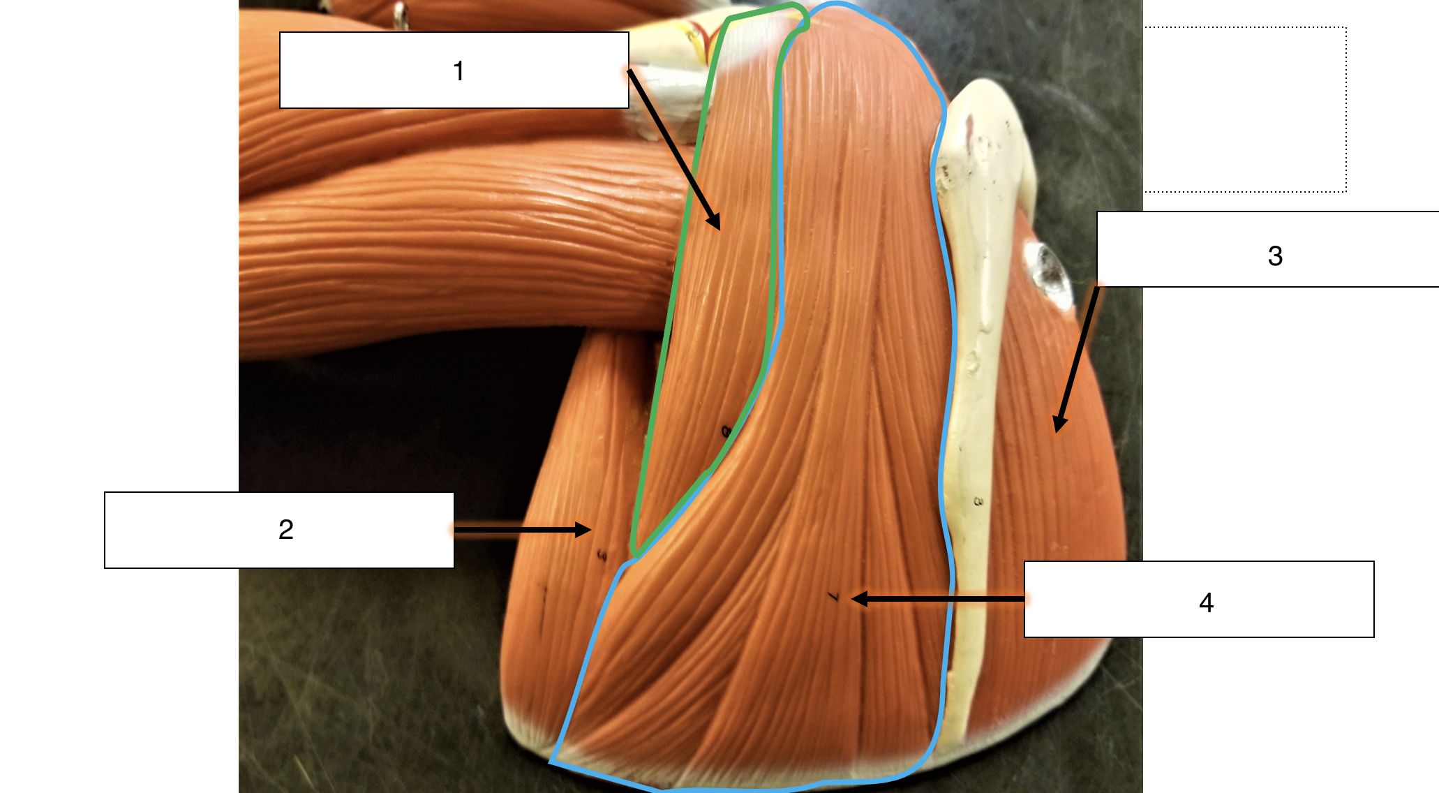 <p>name the muscle (2)</p>