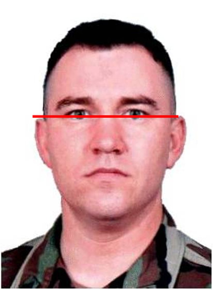<p>Interpupillary line</p>